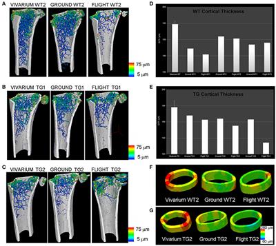 High-Resolution X-Ray Tomography: A 3D Exploration Into the Skeletal Architecture in Mouse Models Submitted to Microgravity Constraints